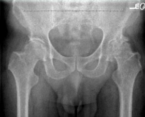Chris's x-ray